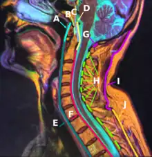 F: Ligamento longitudinal posterior