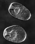 Gástrula de A. planci