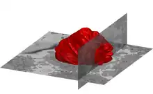 Superficie de la membrana nuclear de una célula HeLa (rojo) y dos imagenes de microscopio electrónico como referencia.
